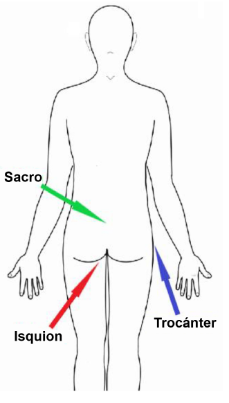Ilustración que muestra la ubicación del isquion, el sacro y los trocánteres en el cuerpo.