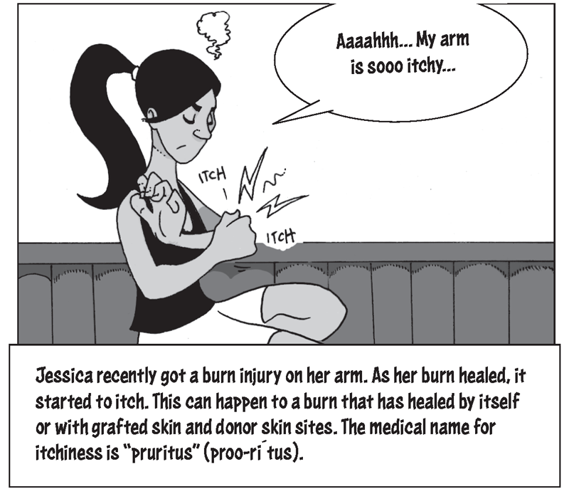 Jessica recently got a burn injury on her arm. As her burn healed, it started to itch. 'My arm is sooo itchy,' she complains. This can happen to a burn that has healed by itself or with grafted skin and donor skin sites. The medical name for itchiness is pruritus (proo-ri´tus).