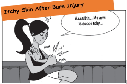 Infocomic: Itchy Skin After Burn Injury