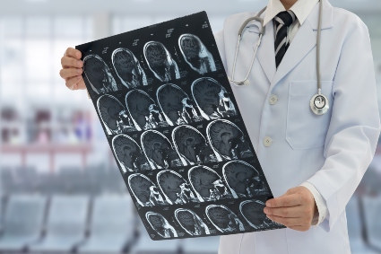 Clinician examining brain scans