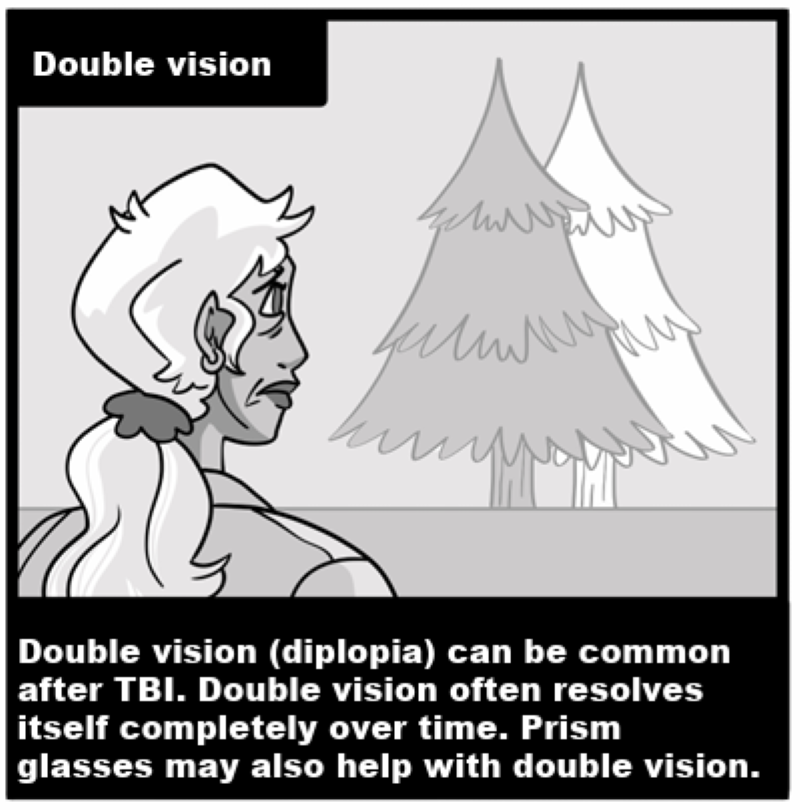 Double vision - Double vision (diplopia) can be common after TBI. Double vision often resolves itself completely over time. Prism glasses may also help with double vision. 