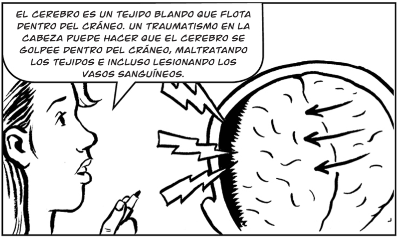 El cerebro es un tejido blando que flota dentro del cráneo. Un traumatismo en la cabeza puede hacer que el cerebro se golpee dentro del cráneo, maltratando los tejidos e incluso lesionando los  vasos sanguíneos.