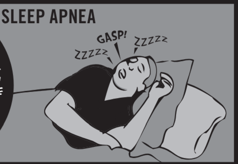 SLEEP APNEA