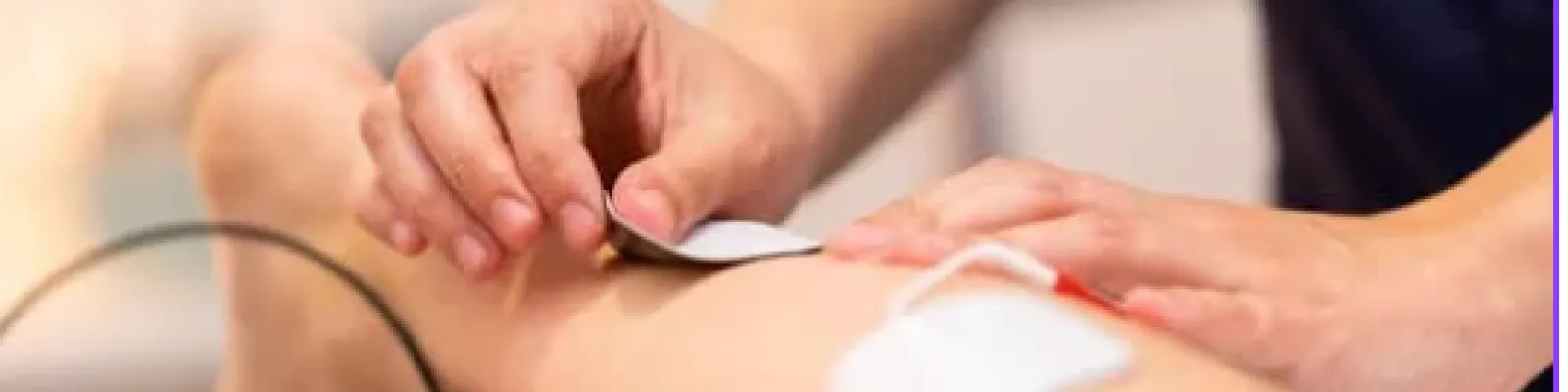 Electric Stimulation