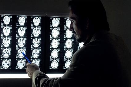 A doctor looking at brain scans