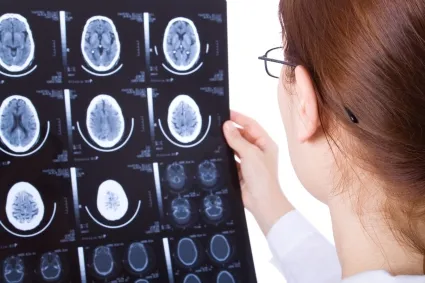 Doctor looking at scans of brain