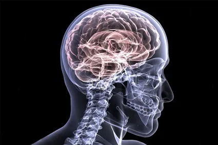 X-ray image of a skull and spinal cord