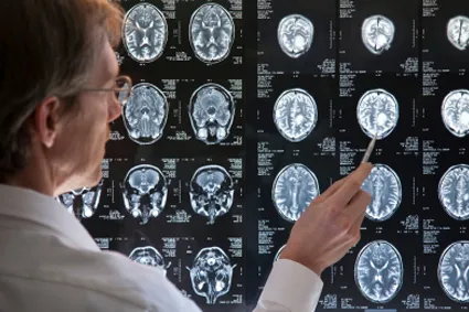 Doctor looking at scans of brain