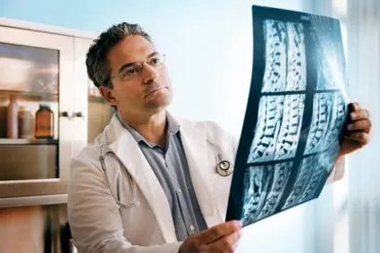 Doctor looking at spinal cord x-ray