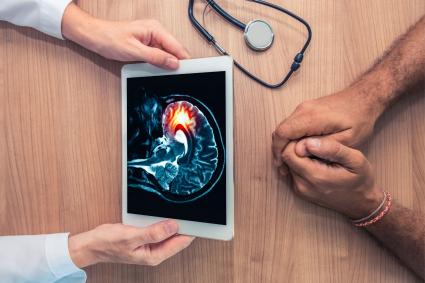 Photo of clinician holding a tablet with a brain image