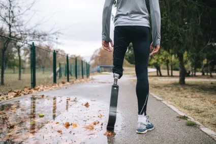 Photo of woman with prosthetic leg about to go on a run