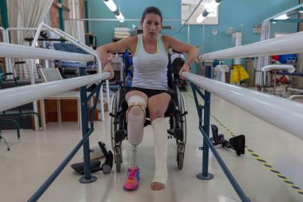 Photo of woman with prosthetic leg at exercise bars