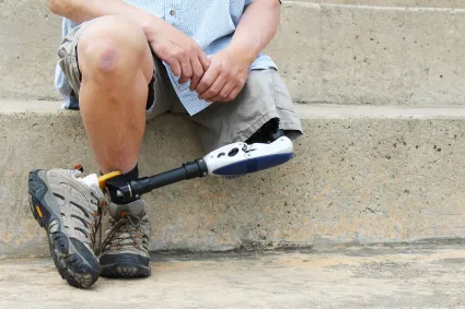 Photo of man's legs, one is a prosthetic