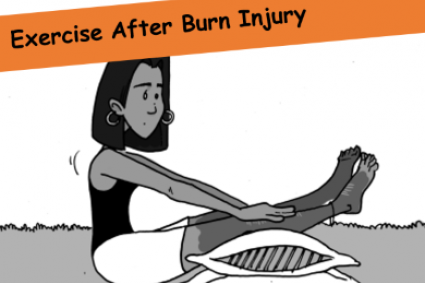 exercise after burn injury