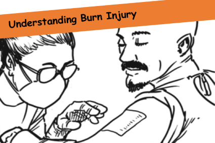 understanding burn injury