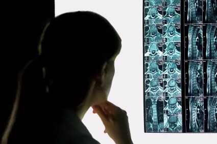 Person looking at an xray of a spine
