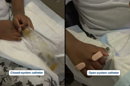 Embedded thumbnail for Bladder Self-Catheterization by a Male with Limited Hand Function