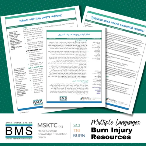 Burn sample post