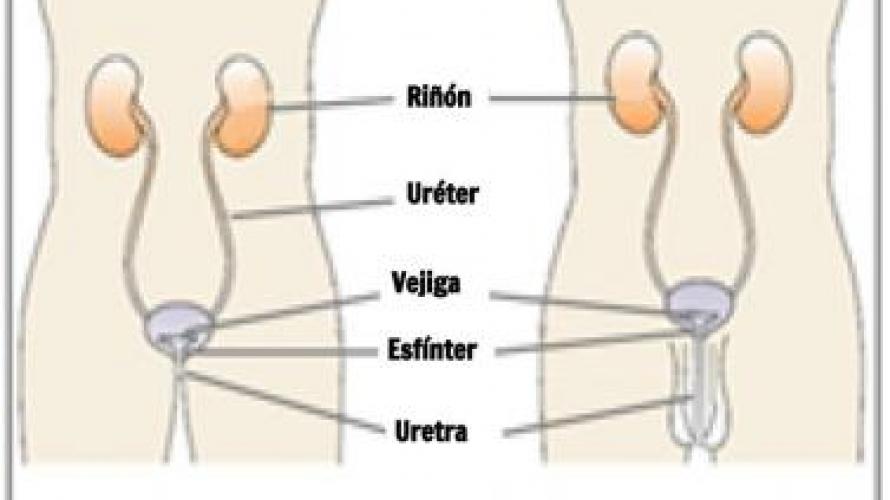 Alternativas de control vesical después de una lesión de la médula espinal 