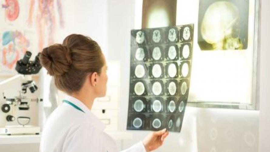 Clinician looking at brain scans