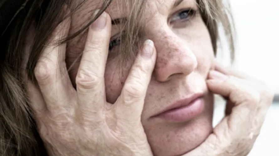 Woman with Burn Injury Looking Into Distance