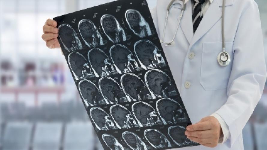 Clinician examining brain scans