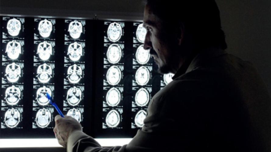 Doctor looking at scans of brain