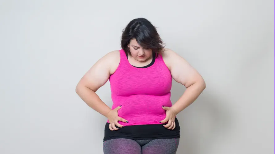 Obese woman