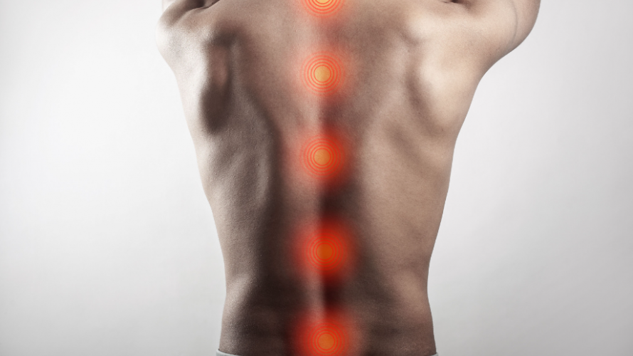 Pain Along Spinal Cord Injury